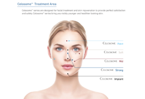 celosome treatment area | FACEPHARM KOREA Co., Ltd.